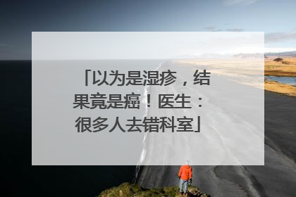 以为是湿疹，结果竟是癌！医生：很多人去错科室