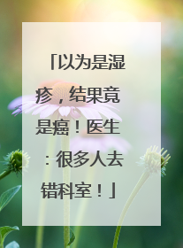 以为是湿疹，结果竟是癌！医生：很多人去错科室！