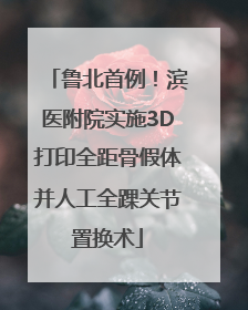鲁北首例!滨医附院实施3D打印全距骨假体并人工全踝关节置换术